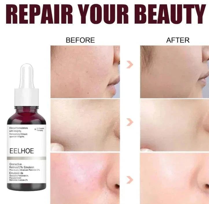 Elera Glow Salicylic Acid Serum 30ml Skin Refining Serum