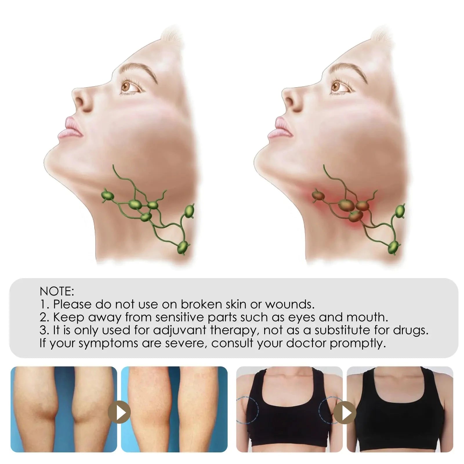 Elera Glow 30g boxed (only for foreign trade export sales, domestic sales are prohibited, purchase is equivalent to default disclaimer) South Moon Lymphatic Care Cream for Neck and Underarm