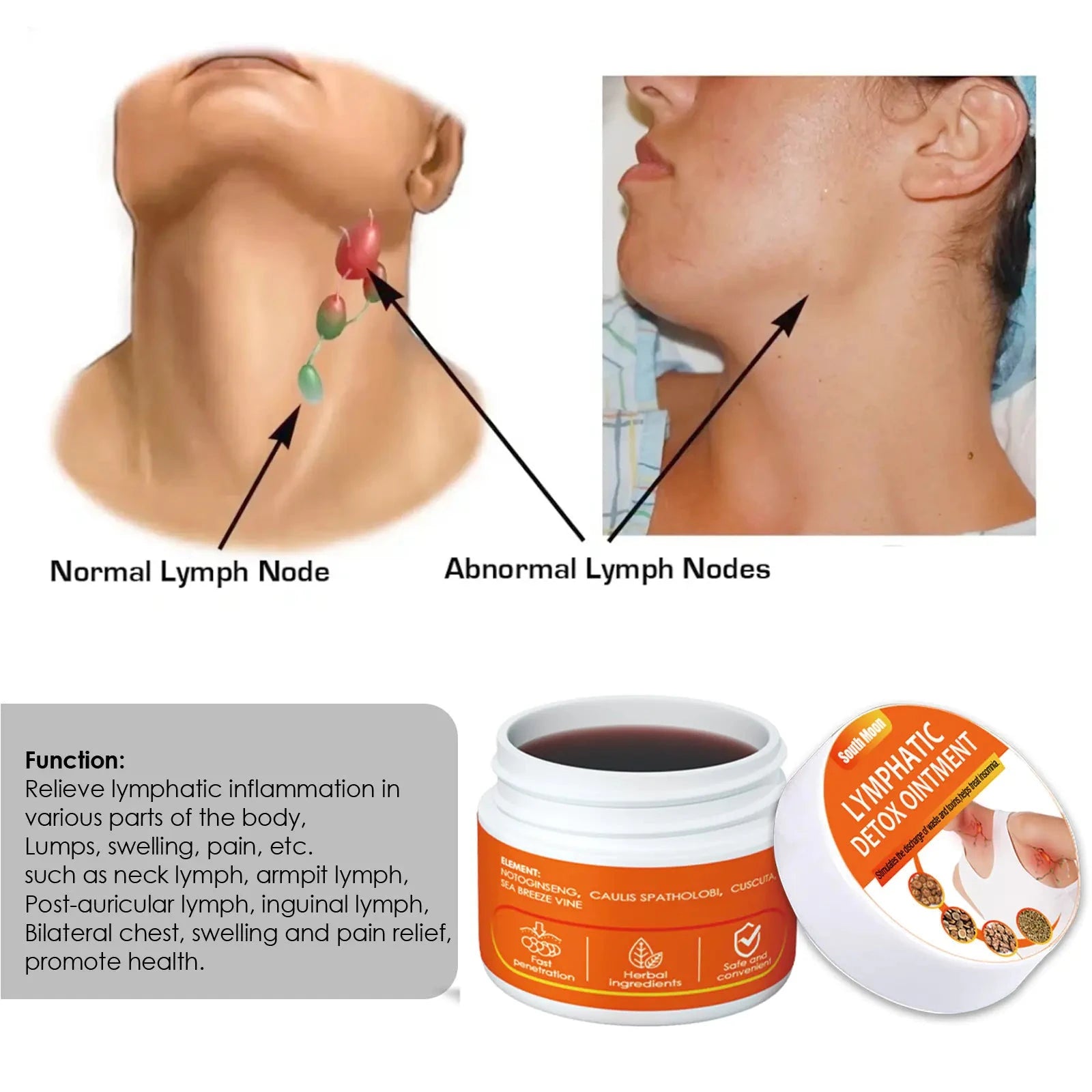 Elera Glow 30g boxed (only for foreign trade export sales, domestic sales are prohibited, purchase is equivalent to default disclaimer) South Moon Lymphatic Care Cream for Neck and Underarm
