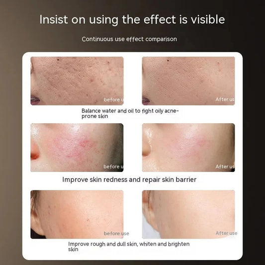 Elera Glow LED IPL Beauty Mask